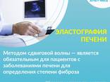 Эластография печени сдвиговой волной в Альт-Мед Одесса - фото 2