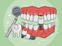 Имплантация зубов | Белая Церковь