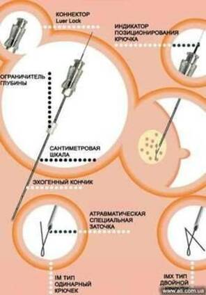 Локализационный крючок для дооперационной локализации