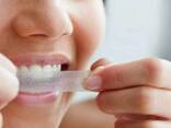 Отбеливающие полоски для зубов Ultra Gel Whitening - фото 2