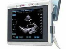 УЗИ аппарат MyLab One